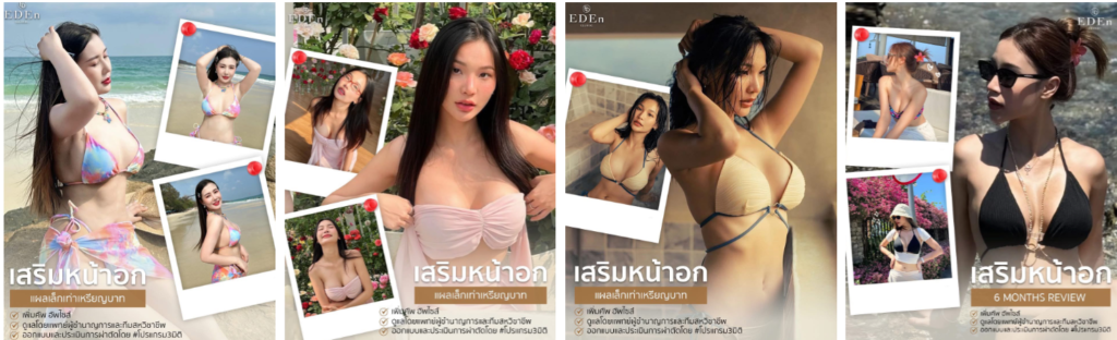 เสริมหน้าอก ที่ไหนดี ราคา